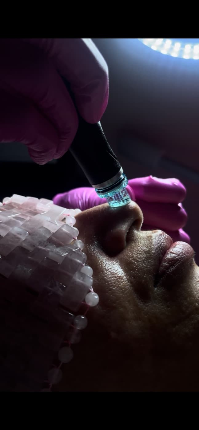 HydraFacial at Lavish Beauty Laser Med Spa in Calgary
